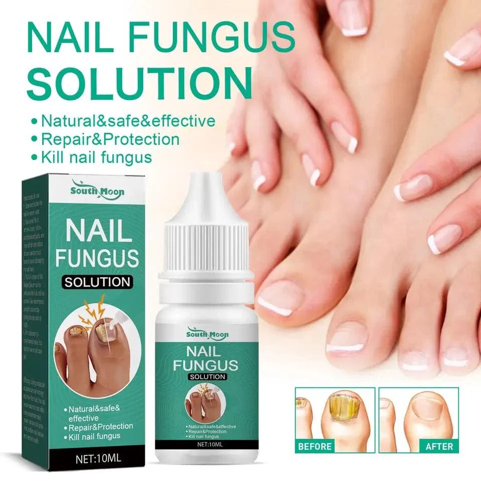 Nail Fungus Solution